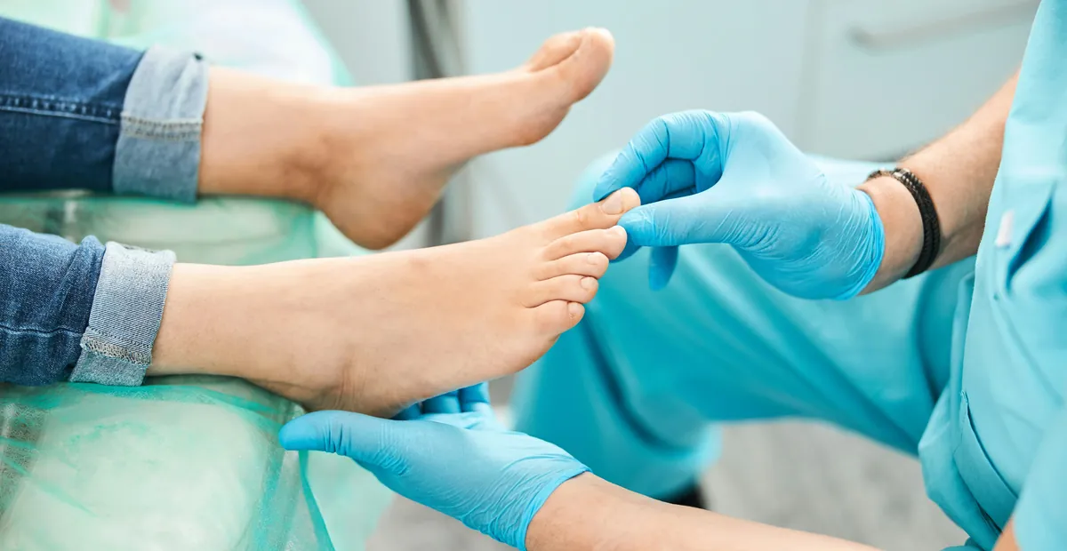 Foot Deformities
