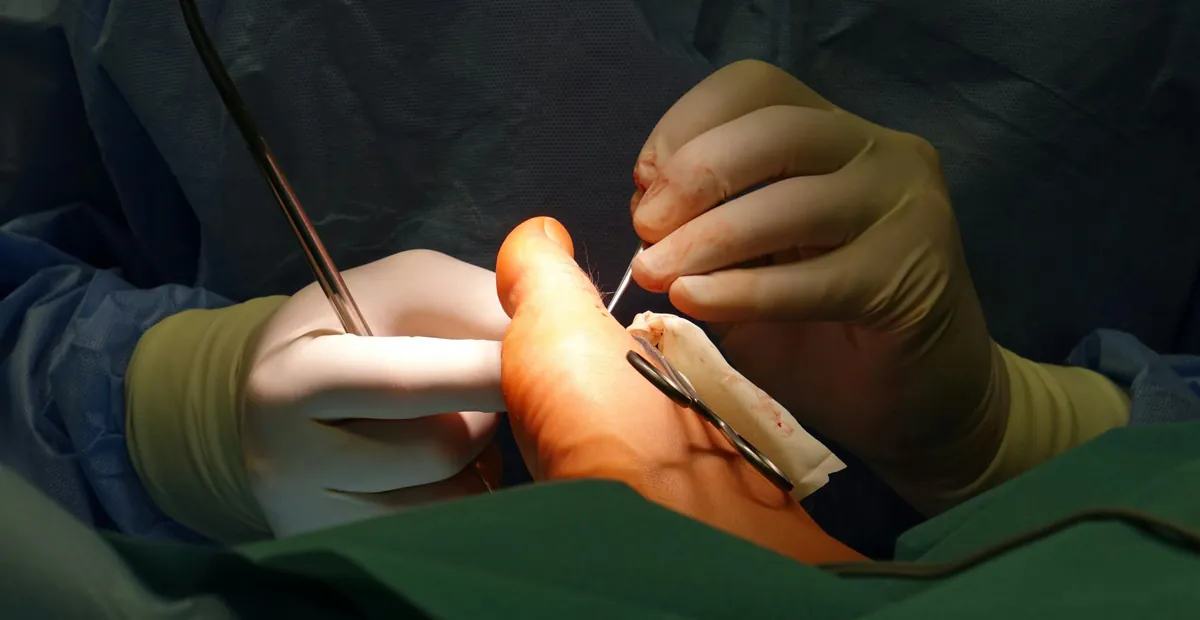 Minimally Invasive Surgery