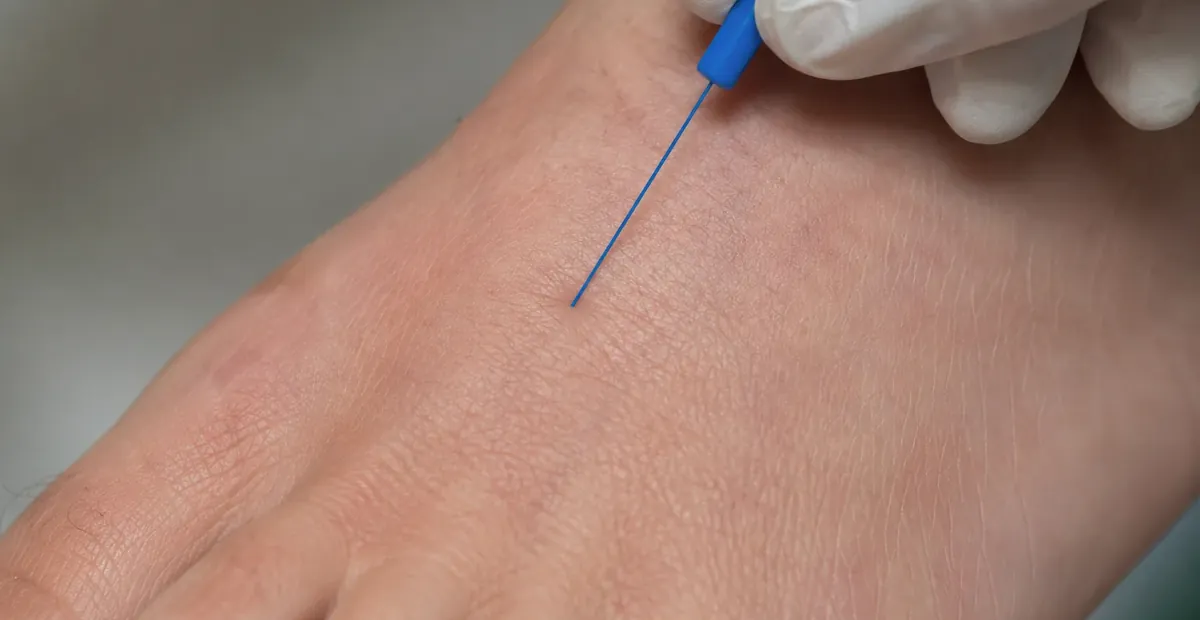 Neuropathy