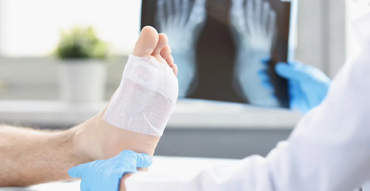 Total Ankle Replacement